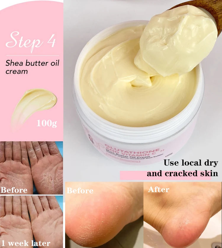 AILKE Whitening Remove Black Spots Facial Skin Care Lotion Moisturizing Cream Body Glutathion Vitamin C Black Skin Face New Set