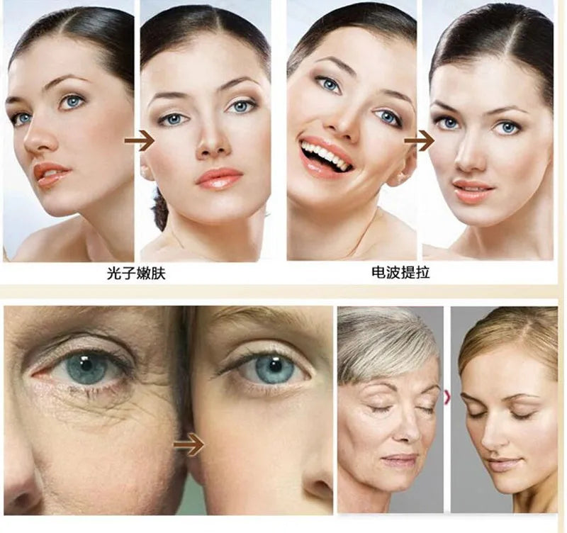 1Pcs 300ml Ultrasonic RF Lifting Skin Wrinkle Moisturizing Facial Cream Gel Tighten Rejuvenate Body Massage Machine