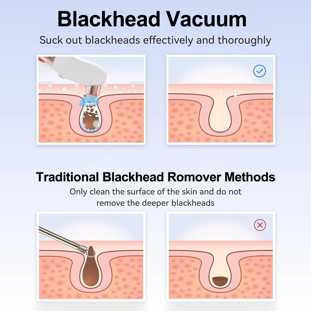 Rechargeable Blackhead Remover Vacuum Facial Pore Cleaner Electric Pimple Blackhead Cleaner Deep Dirt Cleaning Machine for Skin
