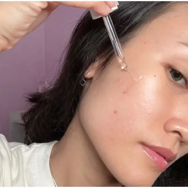 30ml Peach 70% Niacinamide Serum Moisturizing Prevent Dryness Facial Essential Oil Increasing Elasticity Smooth Soften Skin Care