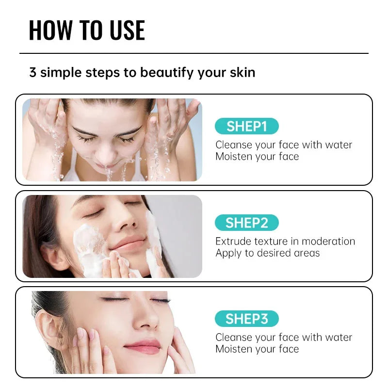 Acne Removal Cream Salicylic Acid Anti-Acne Fade Redness Pimple Scar Gel Shrink Pore Whitening Moisturizing Facial Skin Care 30G