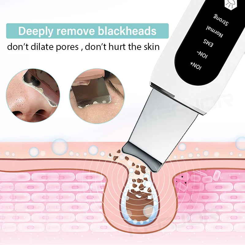 Ultrasonic Skin Scrubber Peeling Acne Blackhead Remover Ultrasonic EMS Ion Acne Pore Face Deep Cleaning Facial Shovel Cleaner
