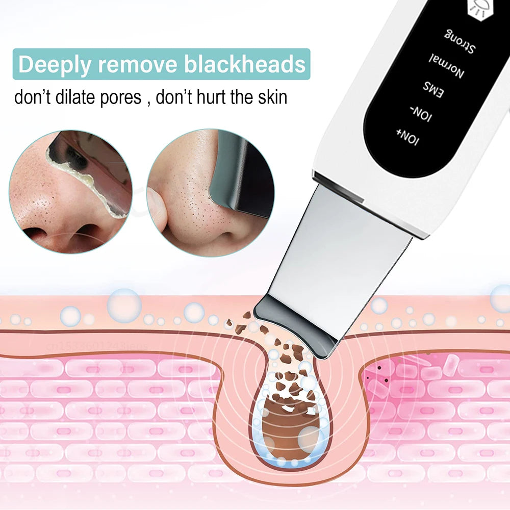 Ultrasonic Skin Scrubber Peeling Acne Blackhead Remover Ultrasonic EMS Ion Acne Pore Face Deep Cleaning Facial Shovel Cleaner