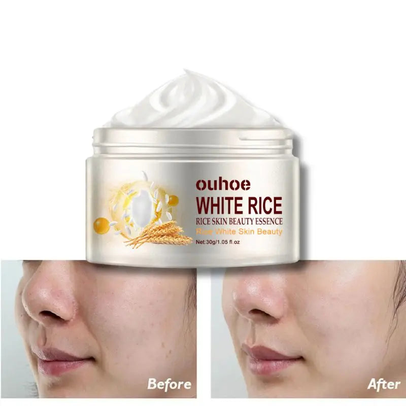 Rice Anti-wrinkle Facial Cream Acne Melasma Treatment Pigmentation Whitening Face Lifting Beauty Moisturizer Korean Cosmetics30g