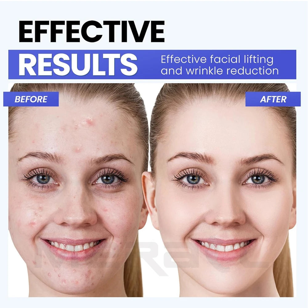 Face Lifting Device EMS Face Massager Skin Tightening Microcurrent Roller Facial Anti Wrinkle Neck Lift Massage Skin Beauty