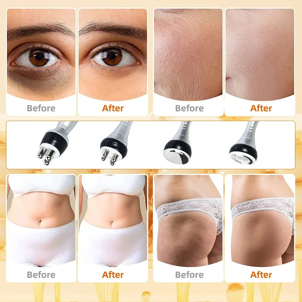 40K 3/4 IN 1 Cavitation Body Slimming Machine Facial Massager Skin Tighten Face Lifting Vacuum Suction Beauty Device