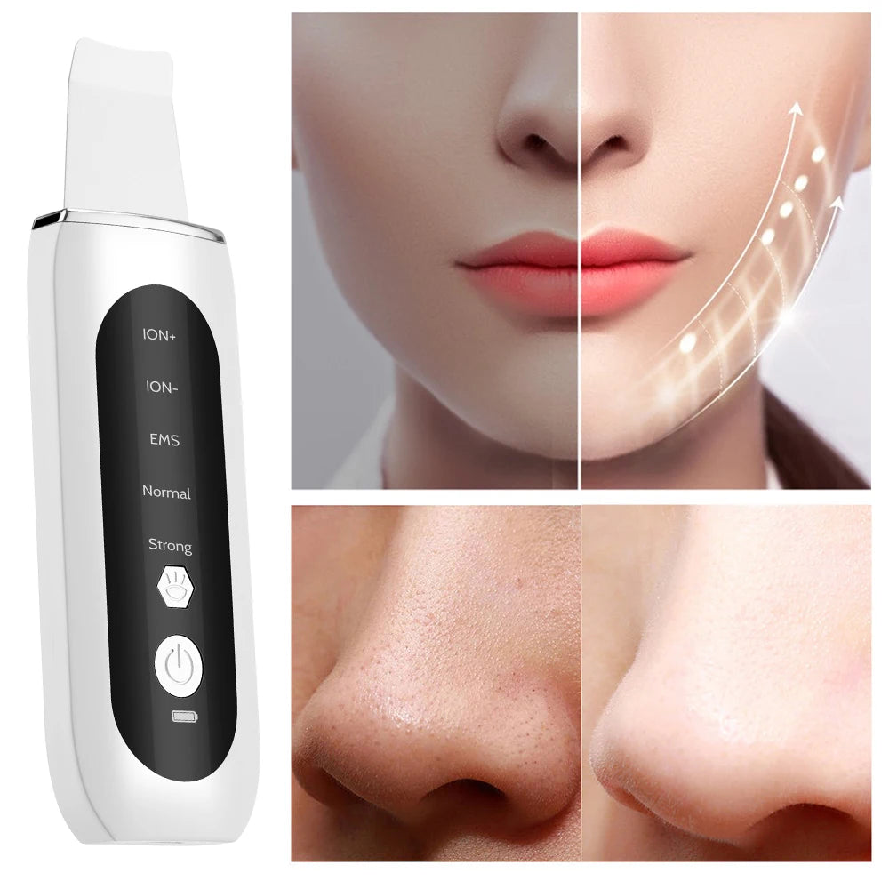 EMS Ultrasonic Cleaner Set Skin Scrubber Face Lifting Spatula Blackhead Remover Shovel Acne Pore Cleaning Facial Skin Care
