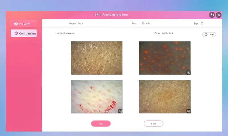 WIFI Wireless Portable Skin Aesthetic Analyzer Digital Skin Scanner Facial Diagnosis Detector Skin Analysis Salon Beauty Machine