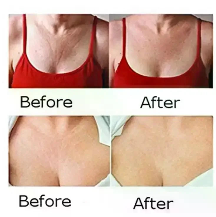 Reusable Silicone Wrinkle Removal Sticker Facial Lifting Strips Set Forehead Neck Line Remover Eye Patches Anti Aging Skin Pads
