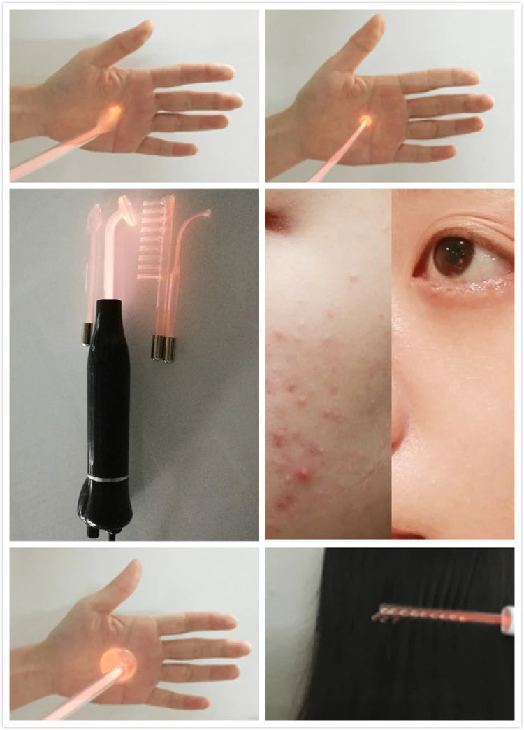 High Frequency Facial Machine Acne Spot Remover Electrotherapy Glass Tube Wand Big Power 30W