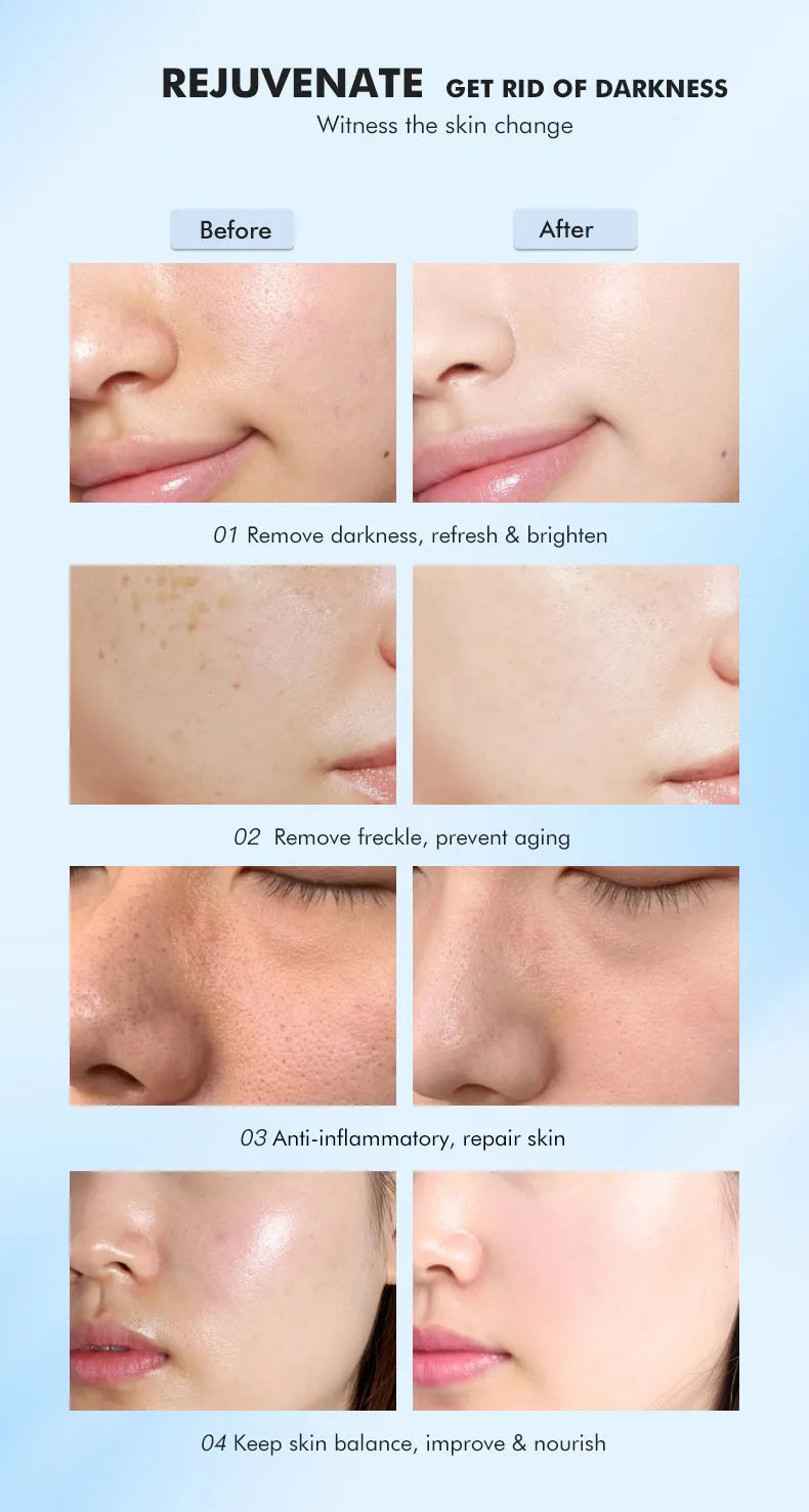 New RF UV Facial Led Red & Blue Acne Spot Treatment Home Use RF Beauty Device Equipment Wand Massager Face Light Therapy Machine