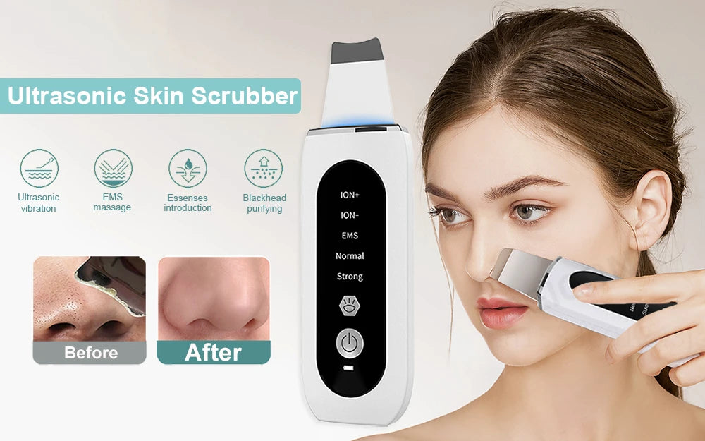 Ultrasonic Skin Scrubber Peeling Acne Blackhead Remover Ultrasonic EMS Ion Acne Pore Face Deep Cleaning Facial Shovel Cleaner