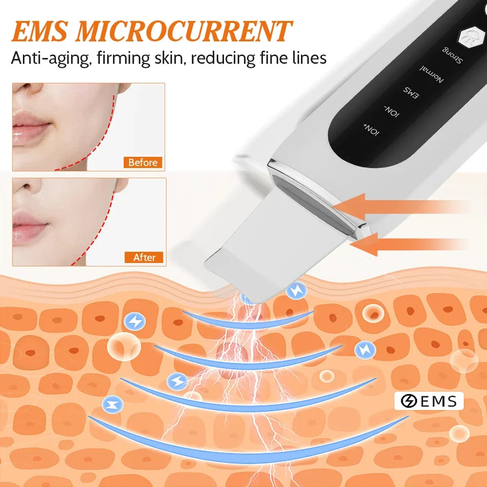 EMS Ultrasonic Cleaner Set Skin Scrubber Face Lifting Spatula Blackhead Remover Shovel Acne Pore Cleaning Facial Skin Care