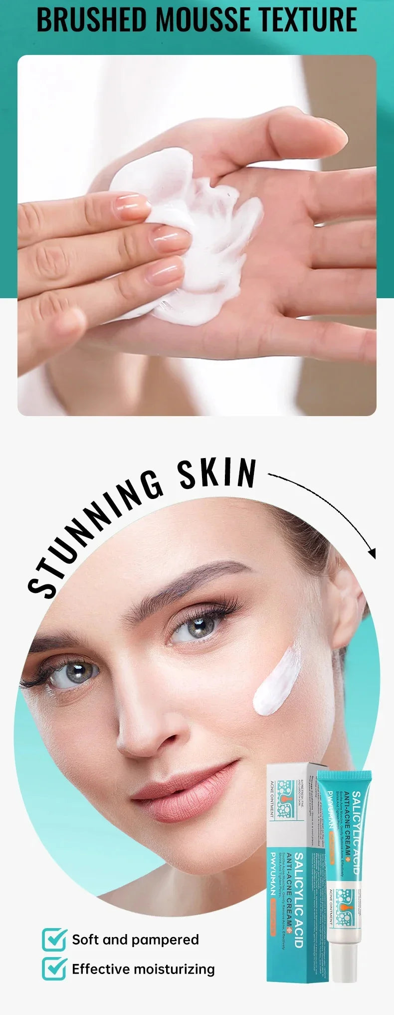 Acne Removal Cream Salicylic Acid Anti-Acne Fade Redness Pimple Scar Gel Shrink Pore Whitening Moisturizing Facial Skin Care 30G