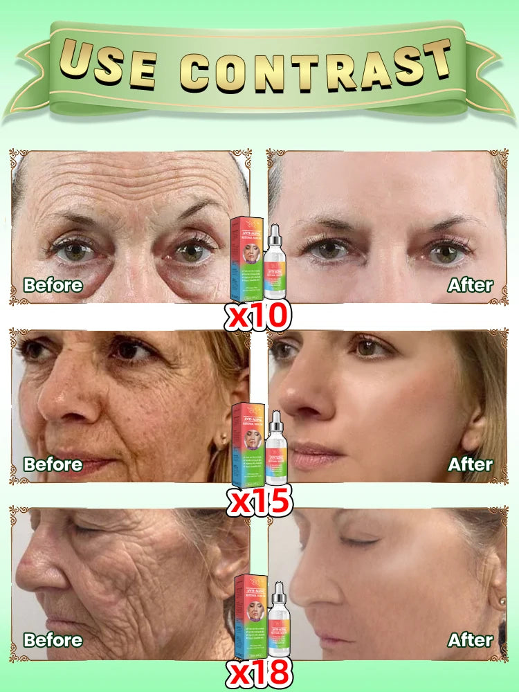 Improve facial wrinkles, go back to 18