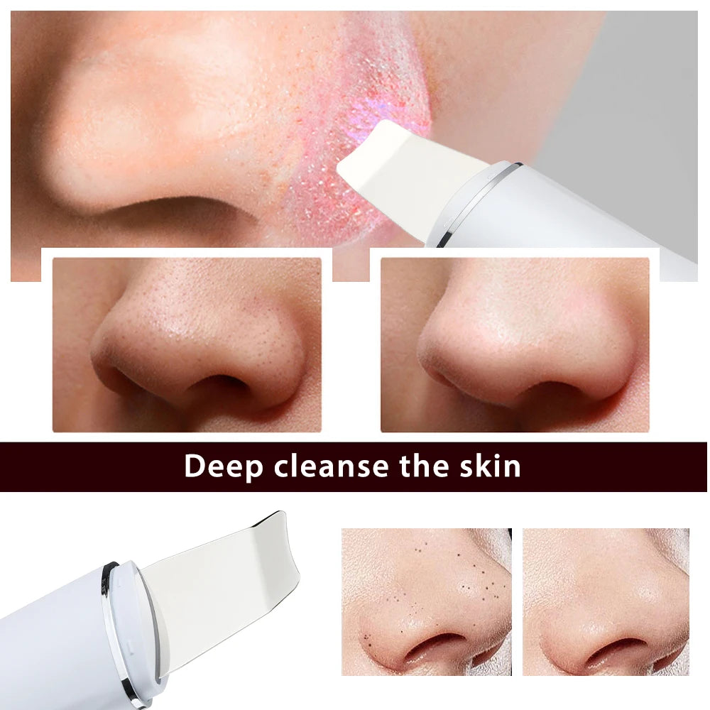 Skin Scrubber Ultrasonic Facial Machine for Home Use Spatula for Blackhead Remover Shovel Peeling Pore Cleaner Face Lift Massage