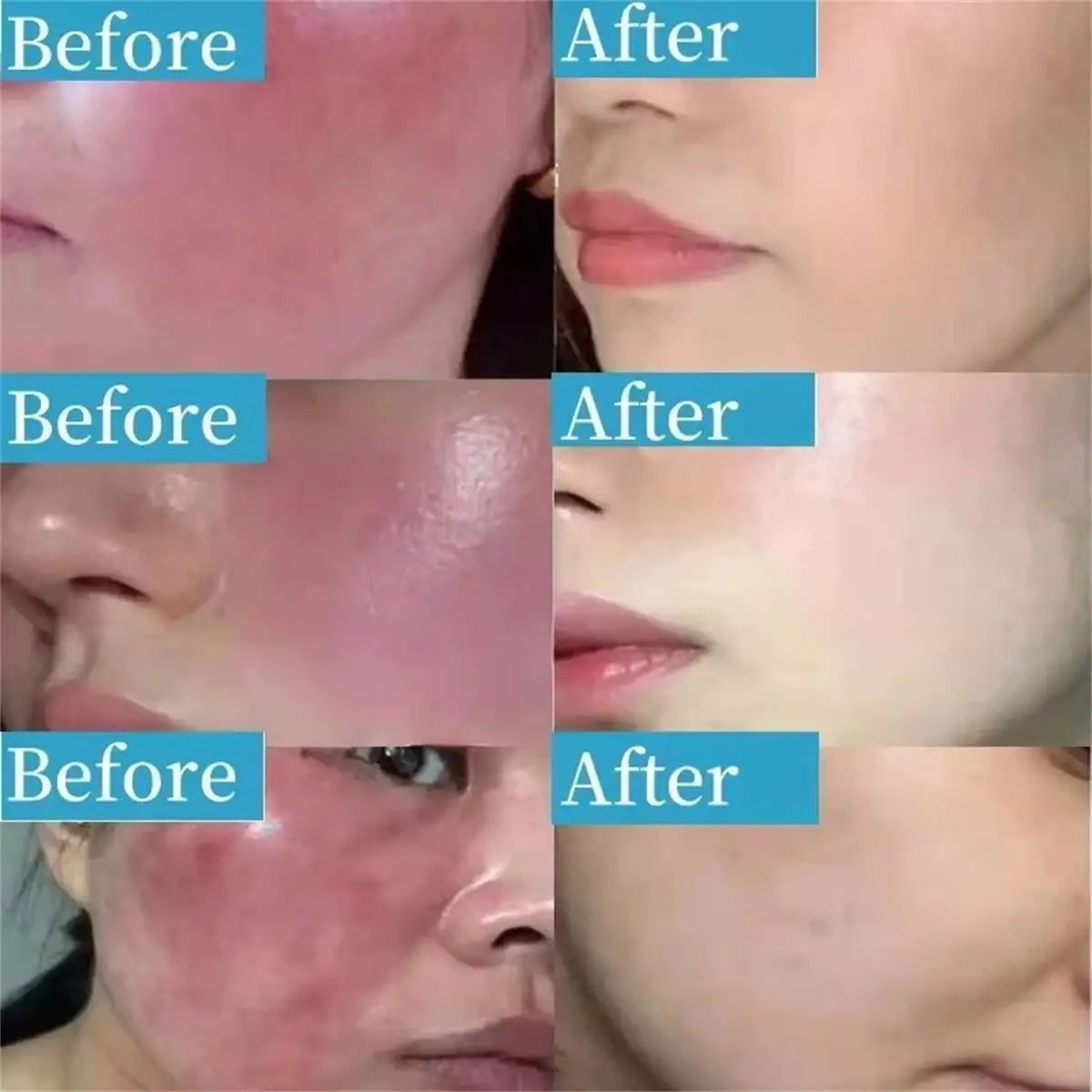 Repair Facial Redness Cream Instant Spider Vein Remove Sensitive Skin Sooth Anti Redness Rosacea Treat Lotion Korean Cosmetics