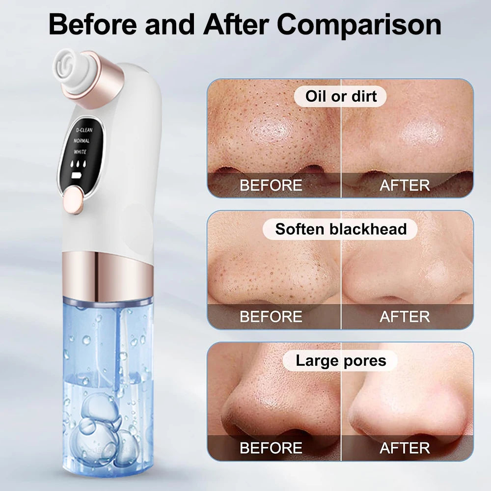 Rechargeable Blackhead Remover Vacuum Facial Pore Cleaner Electric Pimple Blackhead Cleaner Deep Dirt Cleaning Machine for Skin