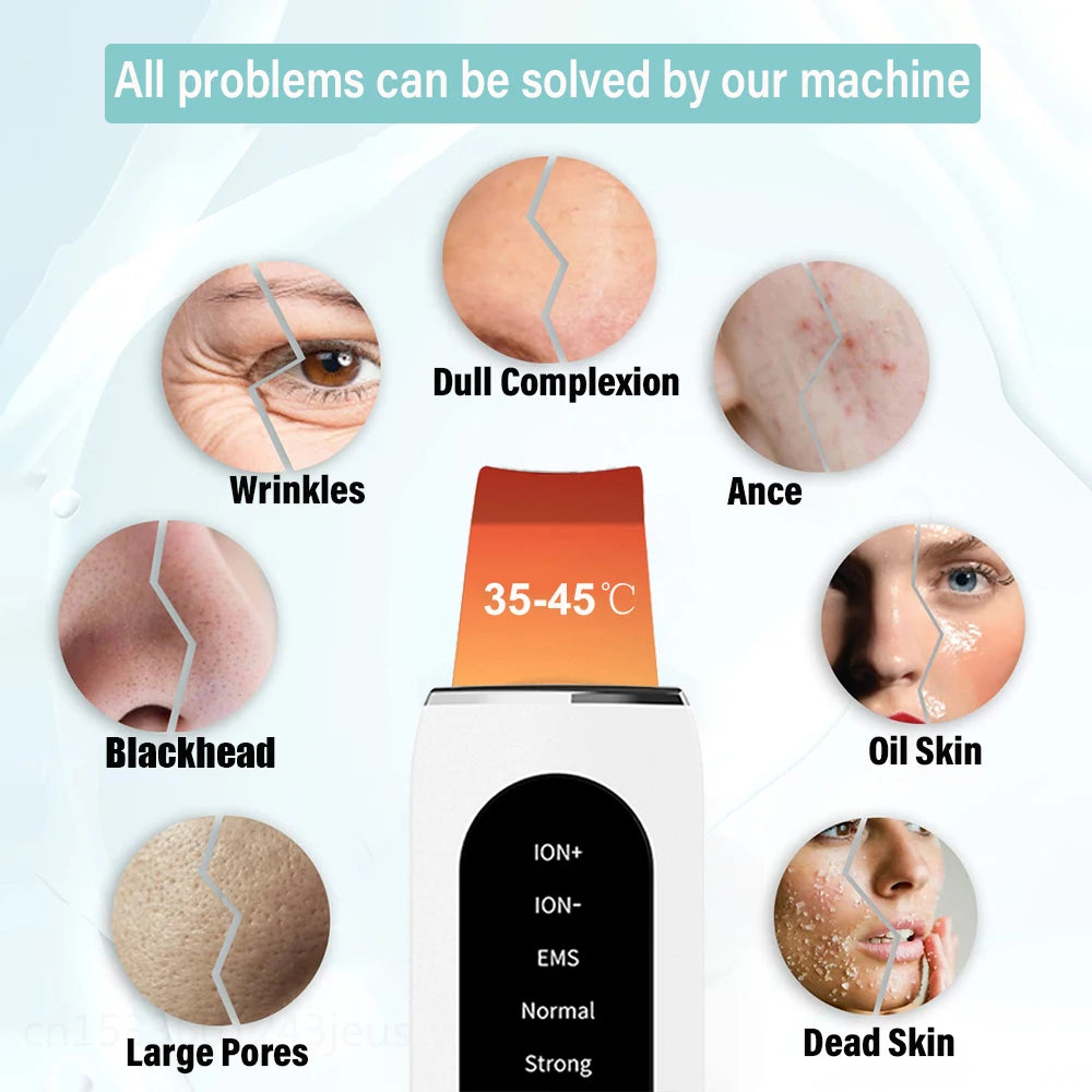 Ultrasonic Skin Scrubber Peeling Acne Blackhead Remover Ultrasonic EMS Ion Acne Pore Face Deep Cleaning Facial Shovel Cleaner