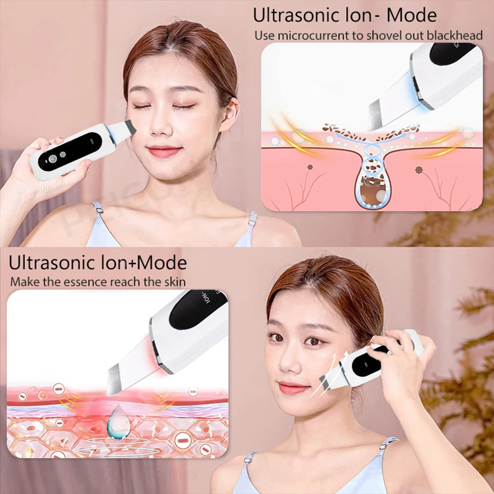 Ultrasonic Skin Scrubber Peeling Acne Blackhead Remover Ultrasonic EMS Ion Acne Pore Face Deep Cleaning Facial Shovel Cleaner