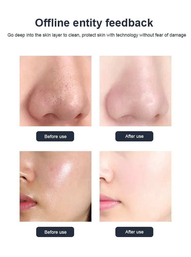 Hot Selling! 10IN1 Water Oxygen Jet Peel Hydro Beauty Skin Cleansing facial Machine Facial Machine Water Aqua Peeling for spa