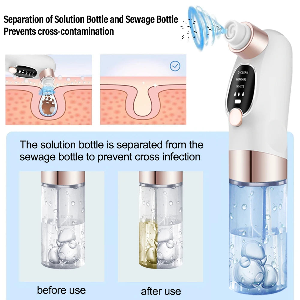 Rechargeable Blackhead Remover Vacuum Facial Pore Cleaner Electric Pimple Blackhead Cleaner Deep Dirt Cleaning Machine for Skin
