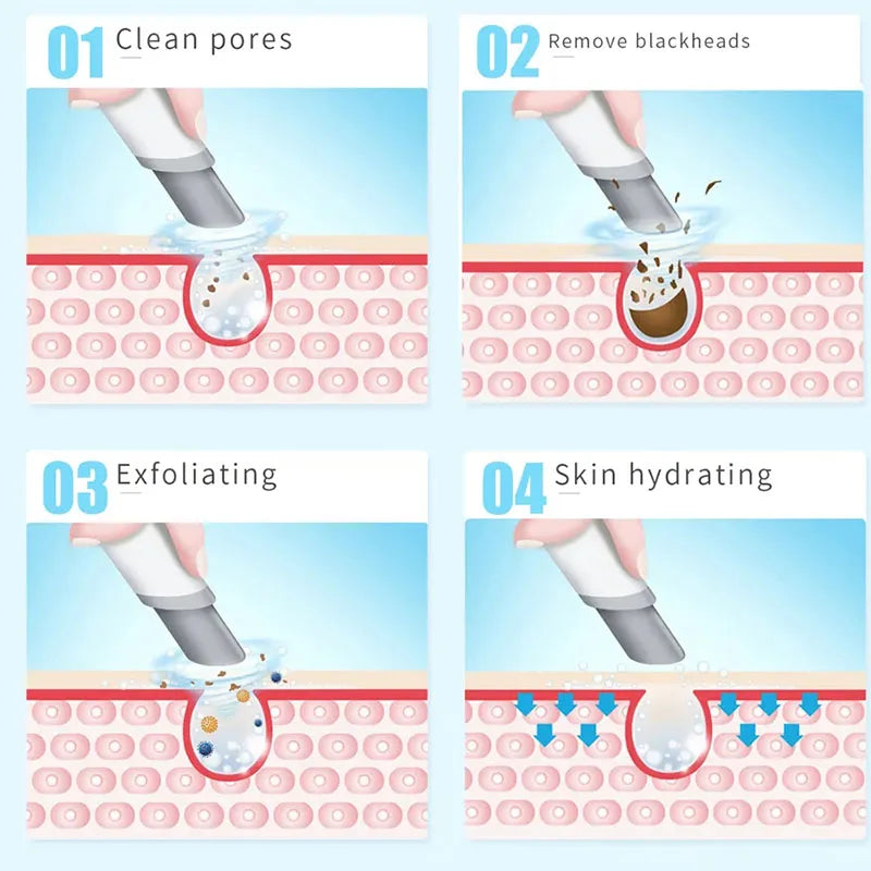Peeling Beauty Device New Small Bubble Oxygen Injection Instrument Hydra Dermabrasion Aqua Facial Cleaning Suction Blackhead
