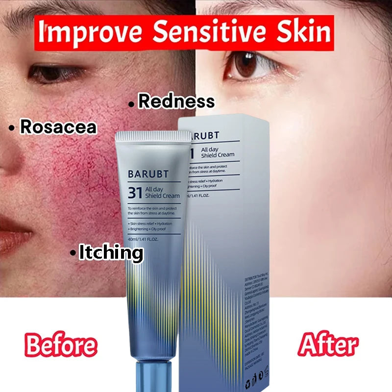 Repair Facial Redness Cream Instant Spider Vein Remove Sensitive Skin Sooth Anti Redness Rosacea Treat Lotion Korean Cosmetics