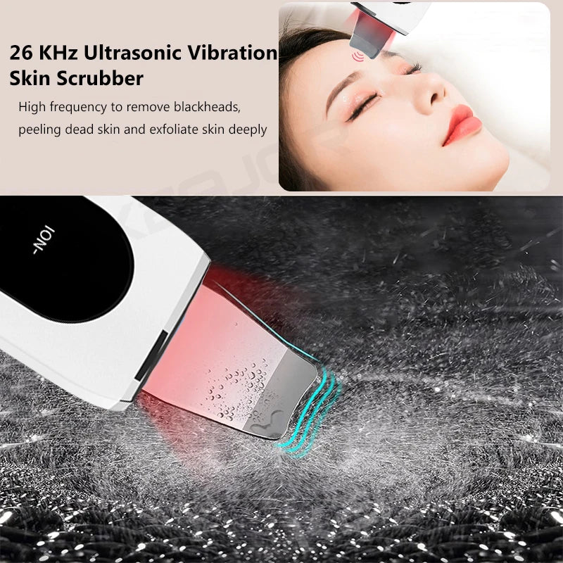 Ultrasonic Skin Scrubber Peeling Acne Blackhead Remover Ultrasonic EMS Ion Acne Pore Face Deep Cleaning Facial Shovel Cleaner
