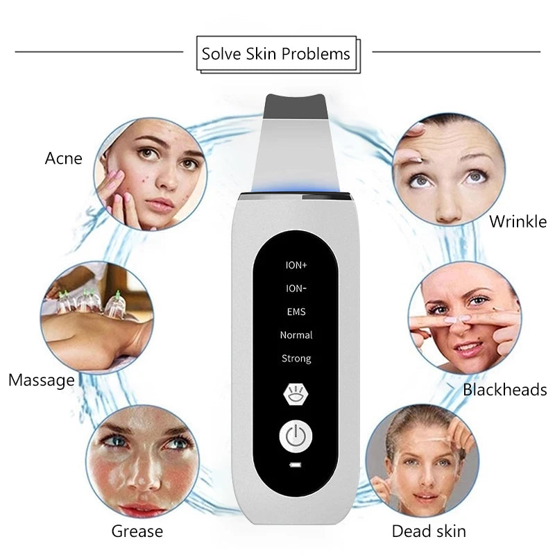 Ultrasonic Skin Scrubber Peeling Acne Blackhead Remover Ultrasonic EMS Ion Acne Pore Face Deep Cleaning Facial Shovel Cleaner
