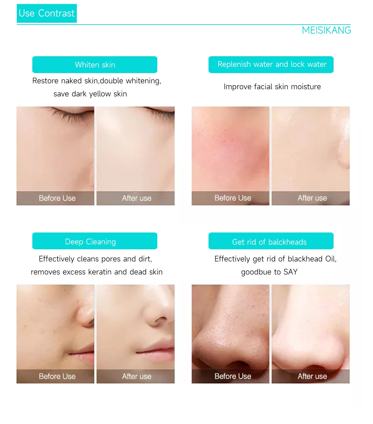 MEISIKANG Dermabrasion Small Bubble Facial Machine Hidrifting Face Cleaning Beauty Device with Trolley