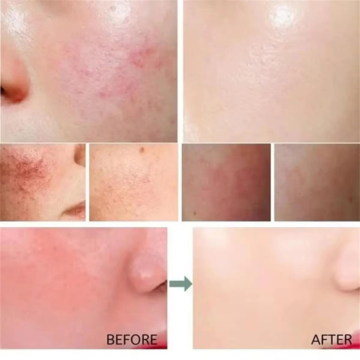 Repair Facial Redness Cream Instant Spider Vein Remove Sensitive Skin Sooth Anti Redness Rosacea Treat Lotion Korean Cosmetics