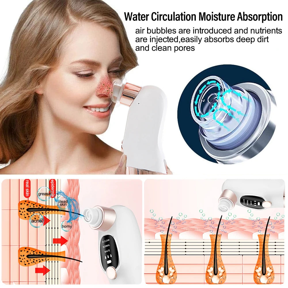 Rechargeable Blackhead Remover Vacuum Facial Pore Cleaner Electric Pimple Blackhead Cleaner Deep Dirt Cleaning Machine for Skin
