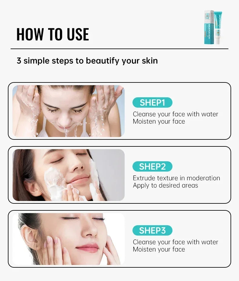 Acne Removal Cream Salicylic Acid Anti-Acne Fade Redness Pimple Scar Gel Shrink Pore Whitening Moisturizing Facial Skin Care 30G