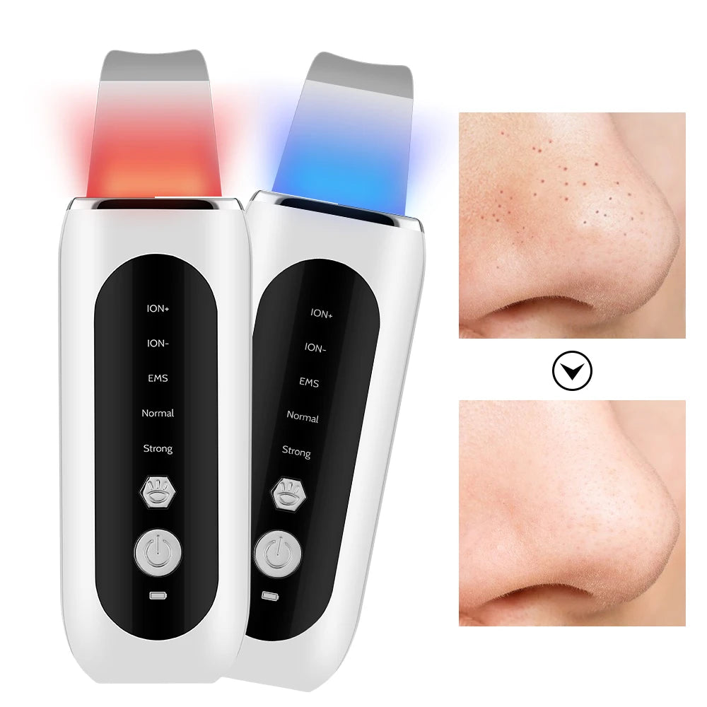 EMS Ultrasonic Cleaner Set Skin Scrubber Face Lifting Spatula Blackhead Remover Shovel Acne Pore Cleaning Facial Skin Care