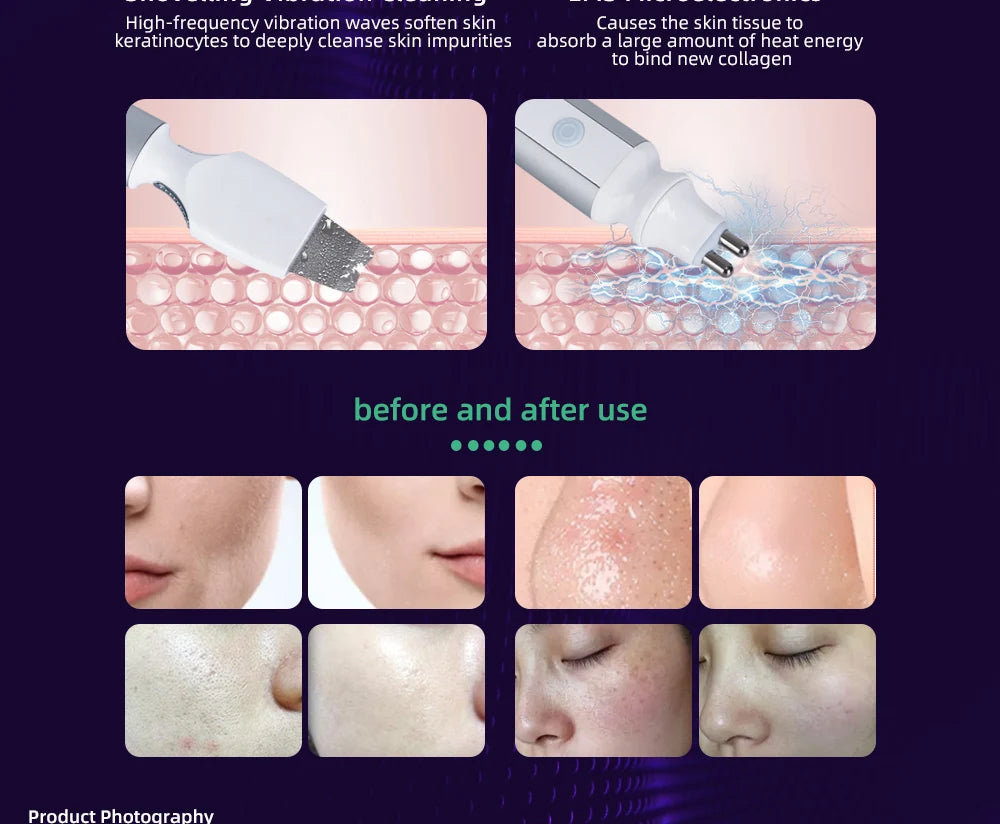New Portable Aqua Peel Hydra Solution Facial Small Bubble H2o2 Cleaning Facial Machine