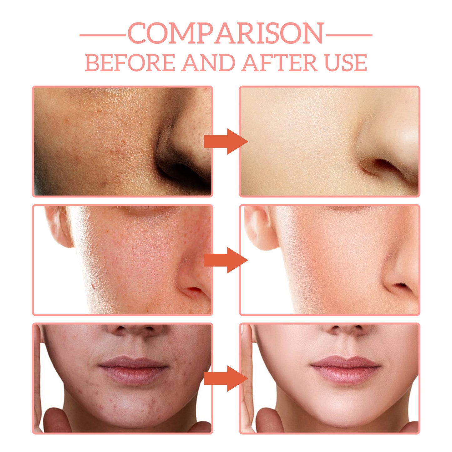 5 In 1 Facial Serum Fade Fine Lines Firming Skin Shrink Pores Moisturizing Brightning Vitamin C Hyaluronic Acid Face Serum