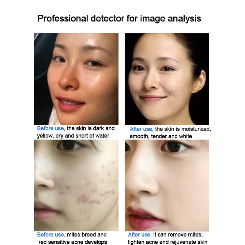 New Magic Oxygen Bubble Beauty Instrument Cleansing Facial Mites Skin Whitening Rejuvenation Management Salon Home Use Device