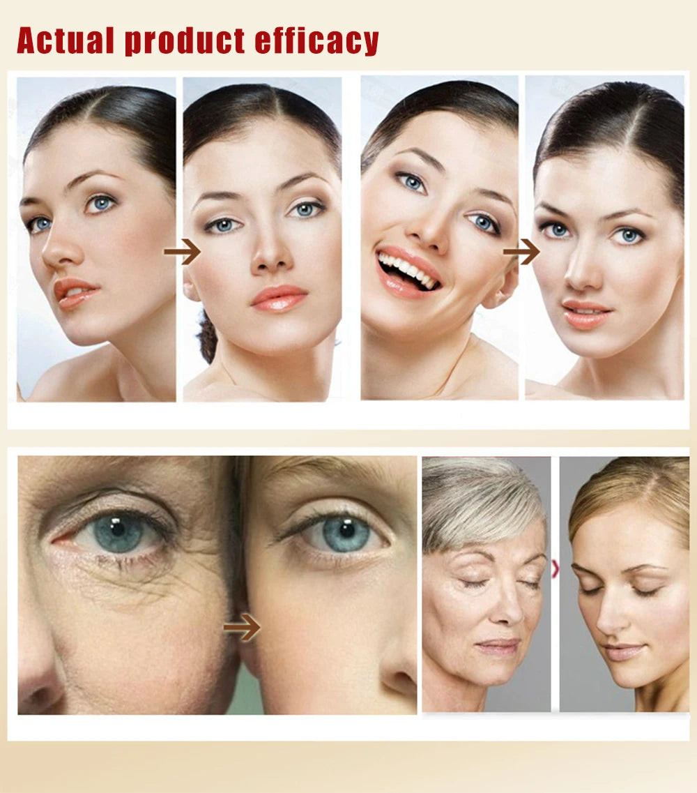 Facial Skin Lifting Firming Tighten Anti Wrinkles Injection Gel Cream RF&EMS Body Slimming Ultrasonic Gel Massager Cavitation