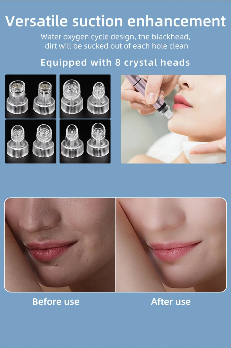 Small Bubble Beauty Device Cleansing Machine Blackhead Removal Water Spray Hydro Jet Face Pores Vacuum Suction Acne Cleaner