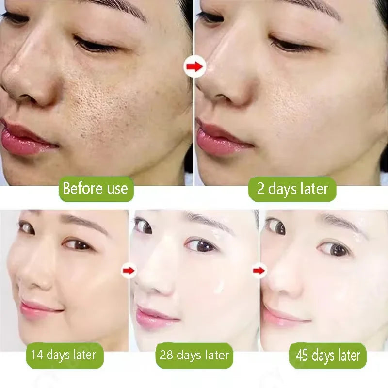 Acidity Pore Shrink Face Serum Remove Blackheads Acne Oil Control Repair Essence Moisturizing Nourish Pores Firming Facial Care