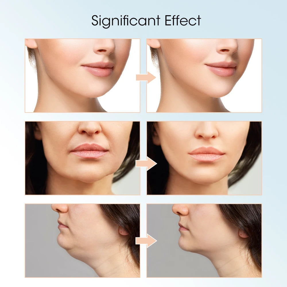 V Face Facial Machine Electric V-Line Up Lift Belt Face Massage LED Face Skin Lifting Firming Beauty Device Double Chin Reducer