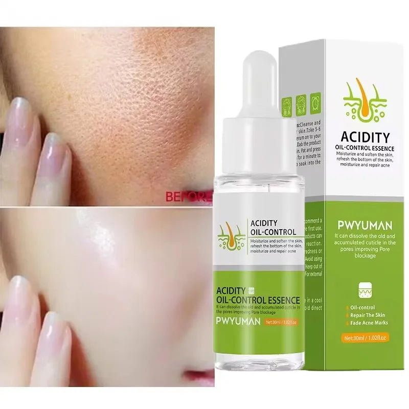 Acidity Pore Shrink Face Serum Remove Blackheads Acne Oil Control Repair Essence Moisturizing Nourish Pores Firming Facial Care