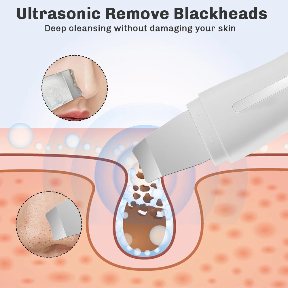 Skin Scrubber Ultrasonic Facial Machine for Home Use Spatula for Blackhead Remover Shovel Peeling Pore Cleaner Face Lift Massage
