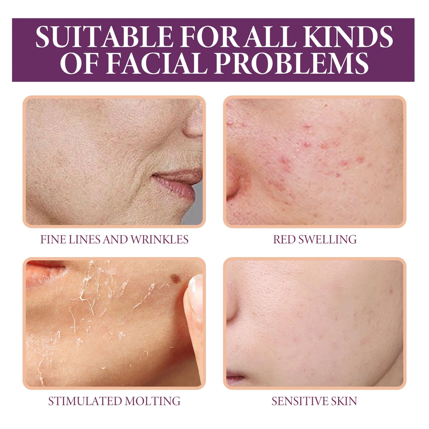 Glycolic Acid 10% Toning Solution Fade Fine Lines Firming Face Serum Improve Facial Dryness Redness Glycolic Acid Repair Essence