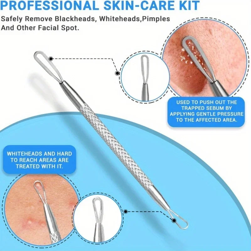 Stainless Steel Blackhead Pore Acne Remover Tool Kit,Professional Facial Cleansing Care Set With Storage Box,Blackhead Extractor