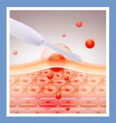 14 in 1 Women Aesthetic Beauty Equipment Bubble Oxygenation Scrubber Facial Machine