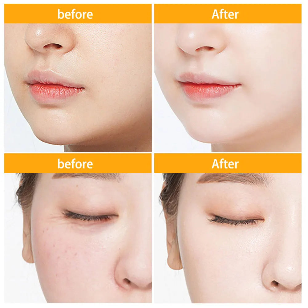 30/150Pcs Hyaluronic Acid Capsules Serum Hydrating Repair Moisturizing Essence Liquid Facial Deeply Nourishes Firming Skin Care