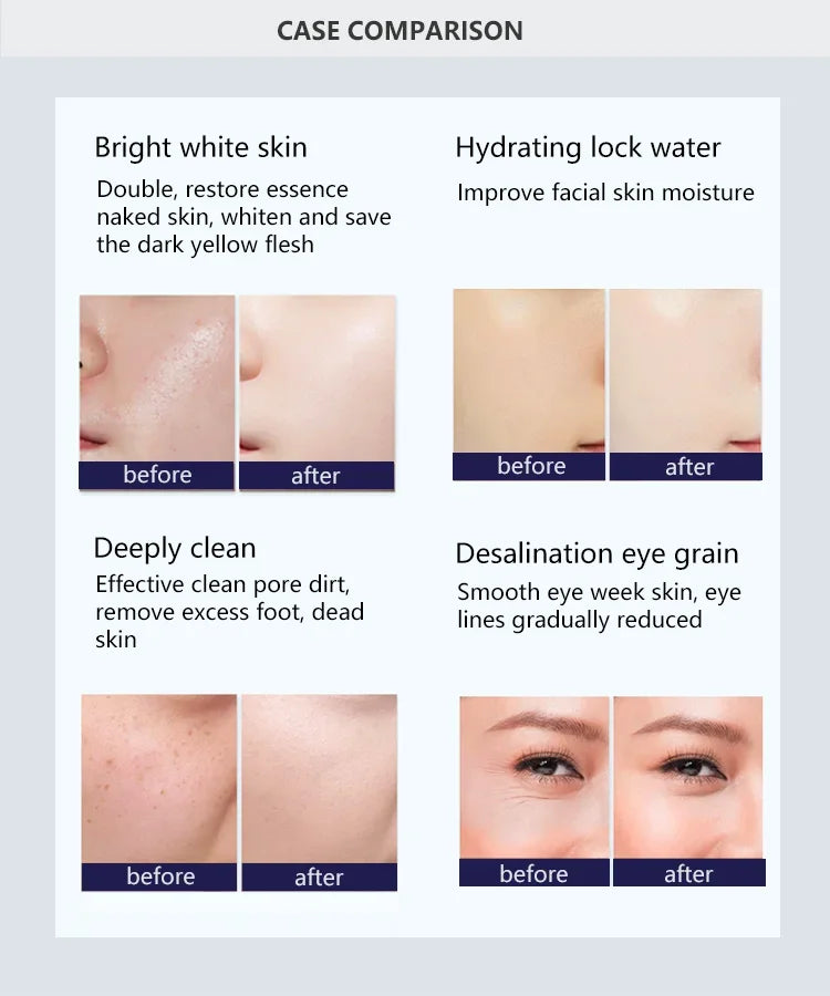 9 In 1 Hydra Professional Machine Aqua Facial Device New Beauty Health Korea Solution Aquaskin Smart Multifunction Oxygen Jet