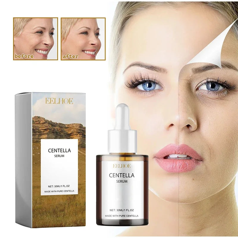 Korean Centella Asiatica Face Serum Nourish Dry Skin Smoothing Rejuvenation Skin Brightening Whitening Cream Facial Moisturizer